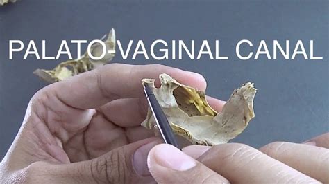 que es fistin vaginal|Vaginal Fisting Guide